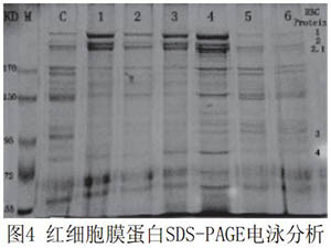 全血pH環(huán)境對紅細胞膜流動性和膜蛋白的影